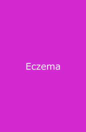 Eczema products